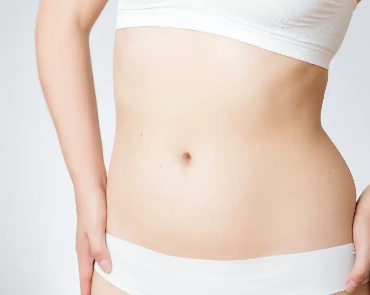 Tummy tuck