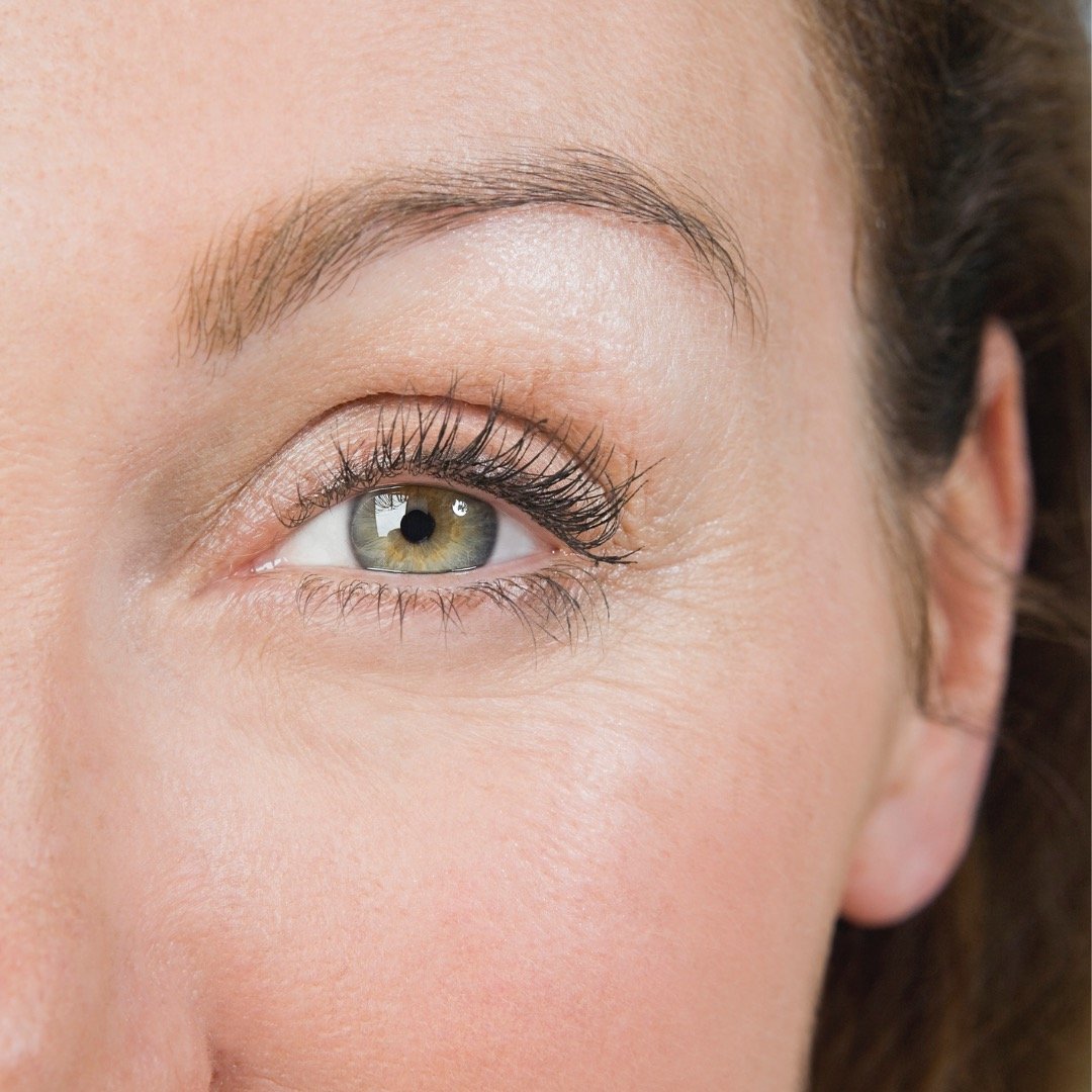 brow lift edinburgh scotland