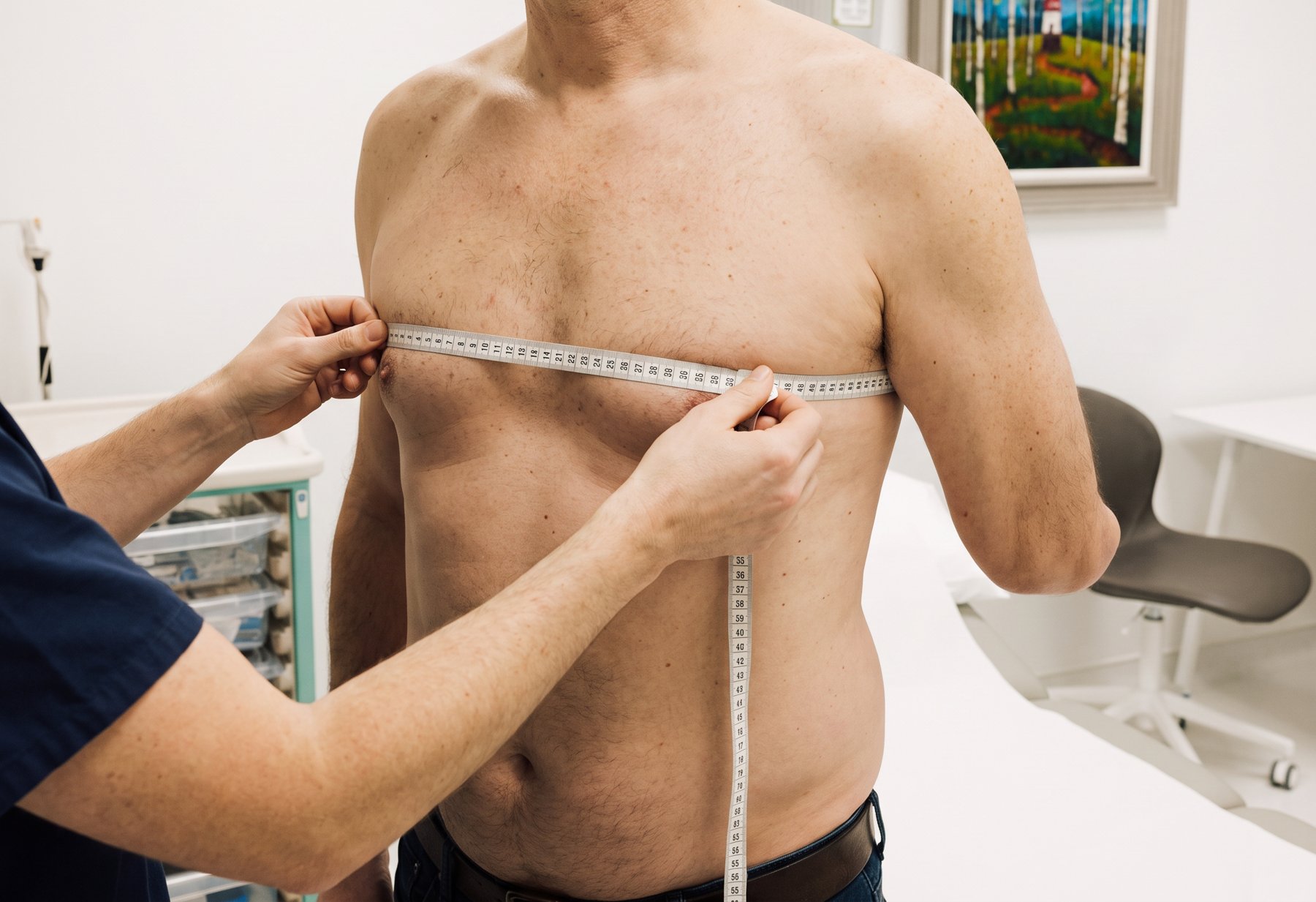 Consultant measuring the chest during a gynaecomastia consultation